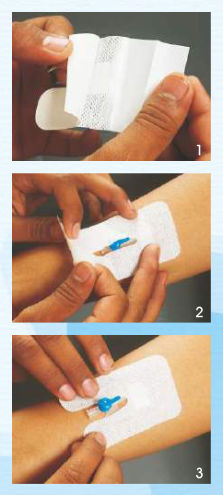 Medigrip IV Cannula Adhesive Bandage - Regular 6 cm x 8 cm IVREG Pack of 50